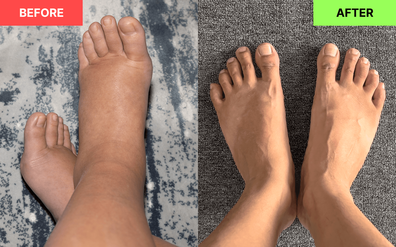Reduce swelling - before and after