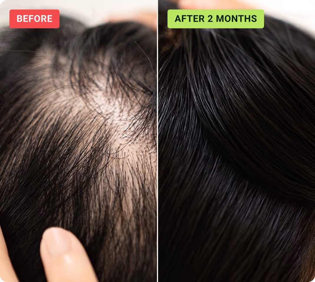 Hair before and after HaloGrow