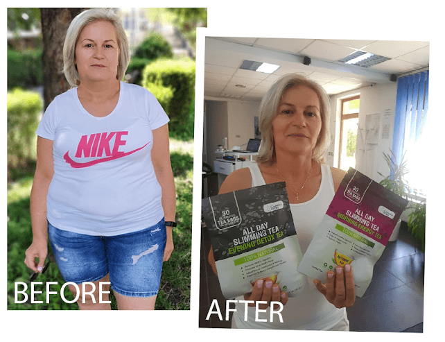 Linda M. before and after