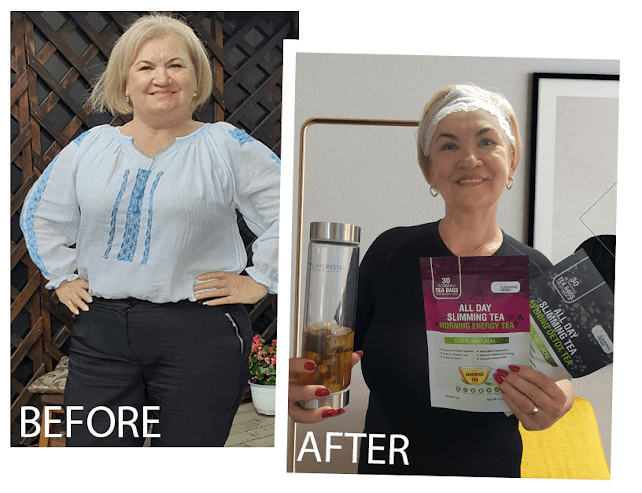 Patricia W. before and after