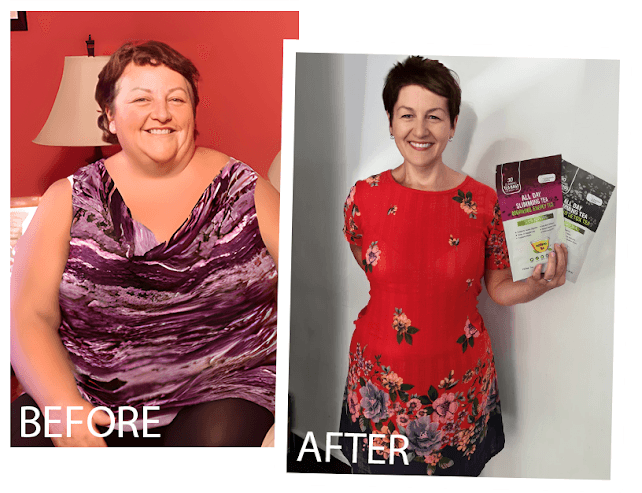 Rhonda K. before and after