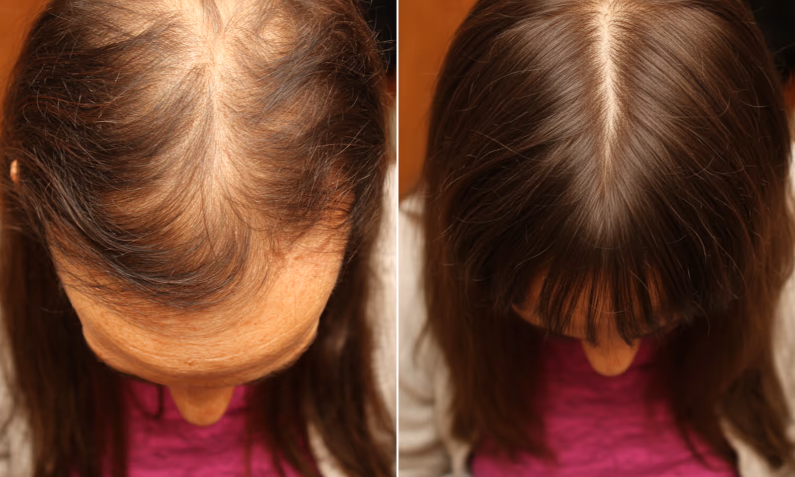 Before and after using HaloGrow