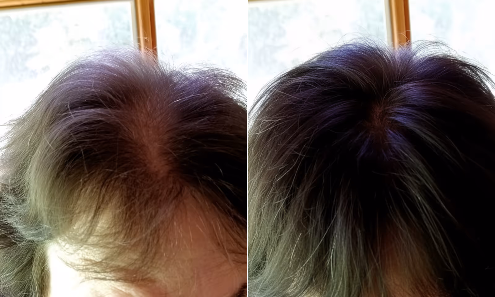 Visible results in 8 to 12 weeks
