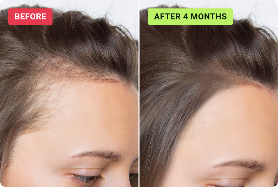 Results — Jessica H., USA